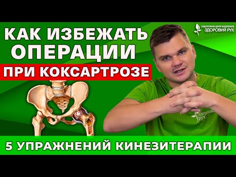 Видео: Эти упражнения ПОМОГУТ снять боль и сохранить сустав при коксартрозе