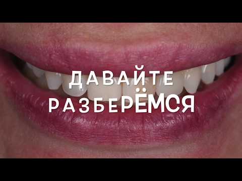 Видео: Как попасть в цвет во время композитной реставрации. Часть 1. А нужна ли расцветка ВИТА ?