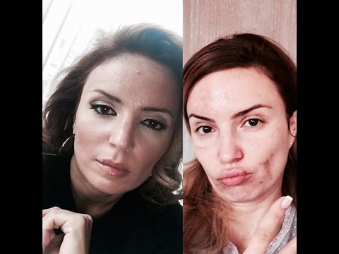 Видео: Еп.2 ОТЛЕПЕТЕ ЕТИКЕТА "ФИЗИЧЕСКИ НЕСЪВЪРШЕН"