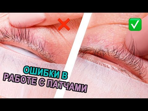 Видео: ПАТЧИ. ИНСТРУКЦИЯ ПО ПРИМЕНЕНИЮ.