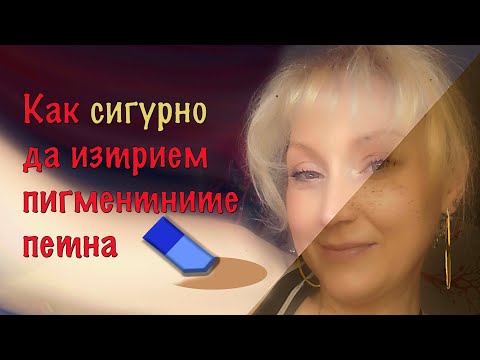 Видео: Как сигурно да изтрием пигментните петна