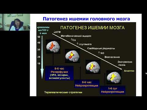 Видео: Усова Н.Н. Симптомы инсульта