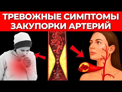 Видео: Эти признаки говорят, что твои артерии уже забиты — узнай до того, как станет поздно!