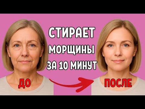 Видео: СОДА И КРАХМАЛ СТИРАЮТ МОРЩИНЫ ДАЖЕ В 70 ЛЕТ!