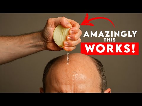 Видео: Луковый сок для роста волос — работает ли он?