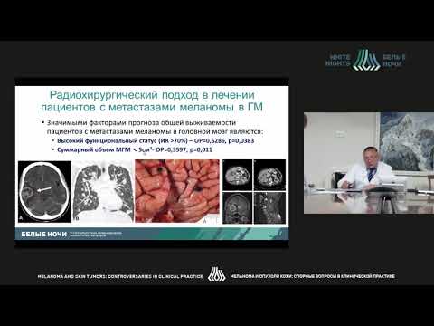 Видео: Какие проблемы при лечении больных с местатическим поражением головного мозга? Взгляд радиолога