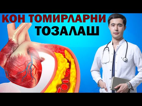 Видео: КОН ТОМИРЛАРНИ ТРОМБДАН ТОЗАЛАШ