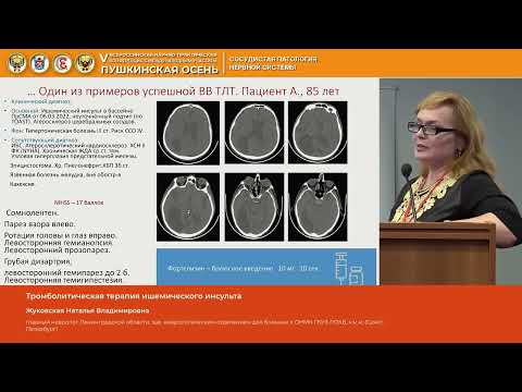 Видео: Жуковская Наталья Владимировна Тромболитическая терапия ишемического инсульта