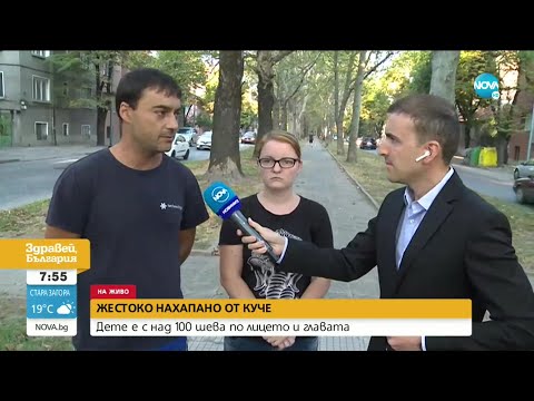 Видео: Жестоко нахапано от куче: Дете е с над 100 шева по лицето и главата