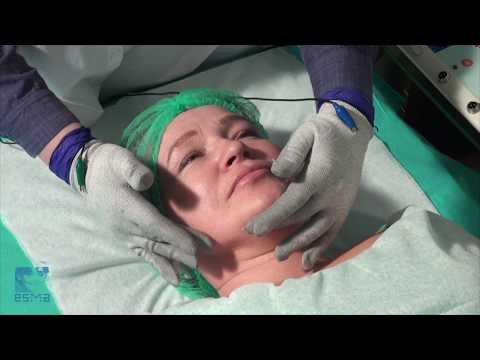 Видео: 🔬 Аппаратно-мануальная терапия микротоковыми перчатками ЭСМА. Косметология. Микротоки.