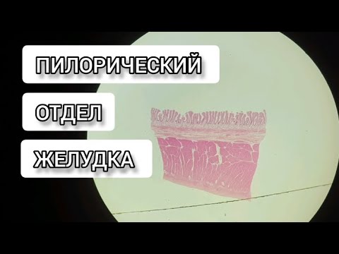 Видео: ПИЛОРИЧЕСКИЙ ОТДЕЛ ЖЕЛУДКА