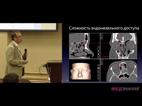 Видео: Хирургия лобной пазухи. Лопатин А.С.
