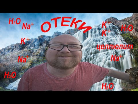 Видео: Отеки и минералы. Целлюлит и как с ним бороться.