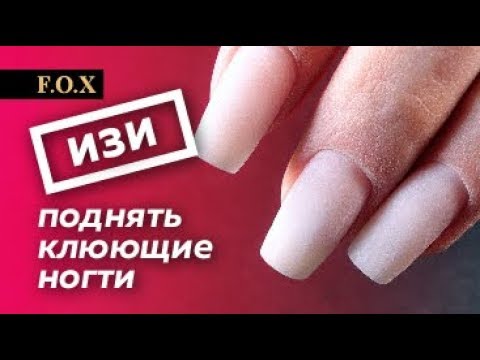 Видео: Поднимаем клюющие ногти после ДРУГОГО МАСТЕРА. Самый легкий способ от Алены Калитки