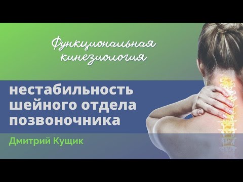 Видео: Нестабильность шейного отдела позвоночника. Причины боли в шее, головной боли. Дмитрий Кущик