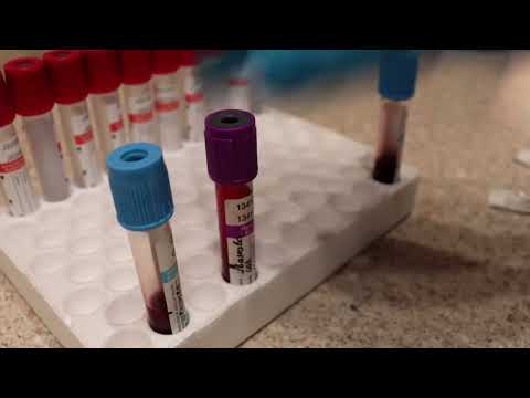 Видео: Приготовление мазка крови собаки  #ветеринарныйврач #анализкрови  #пироплазмоз