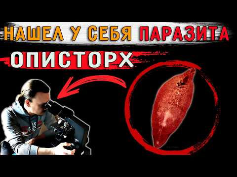 Видео: Нашел у себя под микроскопом описторхов! Пропил антипаразитарку. Что стало?