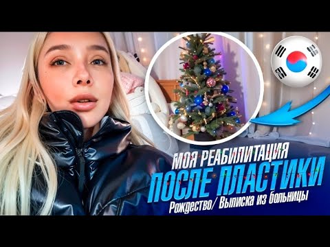 Видео: Моя реабилитация после пластики/Рождество/ Выписка из больницы/Korea vlog