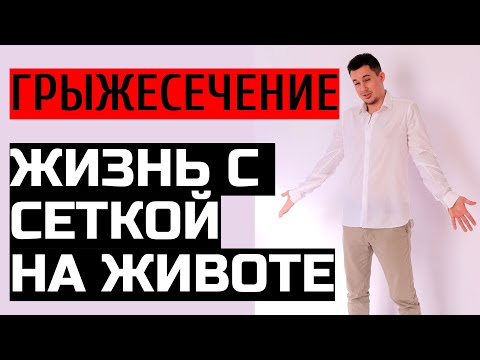 Видео: Грыжесечение | Жизнь с сеткой на животе
