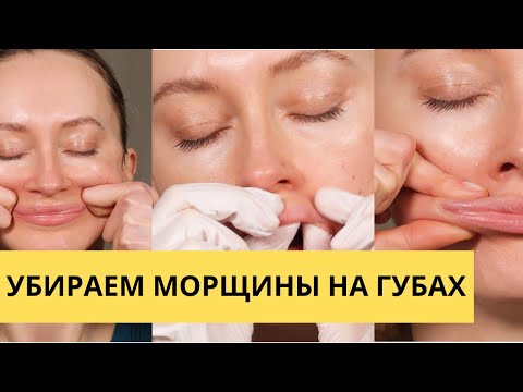 Видео: Убираем морщины над верхней губой (кисетные морщины)
