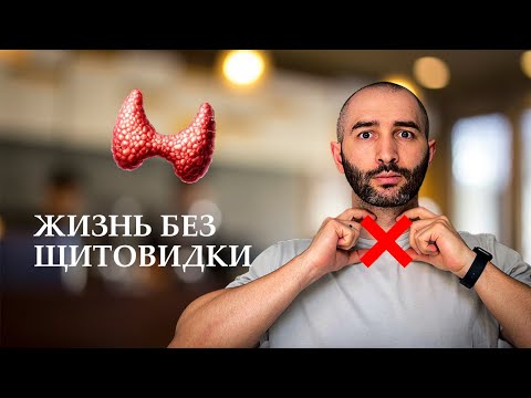 Видео: Жизнь ПОСЛЕ УДАЛЕНИЯ щитовидки. Советы врача