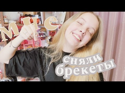 Видео: МНЕ СНЯЛИ БРЕКЕТЫ | история моих зубов