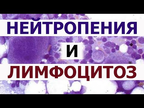 Видео: Нейтрофилы понижены лимфоциты повышены. Лейкоцитарная формула крови. Нейтропения Лимфоцитоз.