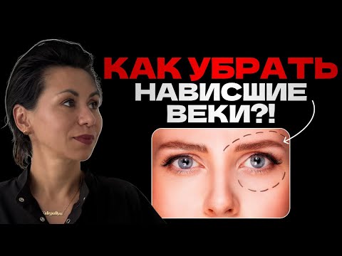 Видео: БЛЕФАРОПЛАСТИКА верхних век: как вернуть свежесть взгляду?!