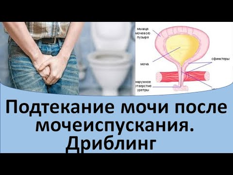 Видео: Подтекание мочи после мочеиспускания.  Дриблинг