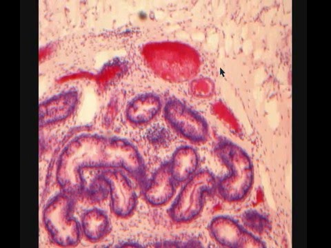 Видео: ПРИДАТОК ЯИЧКА  гистологическое строение  EPIDIDYMIS