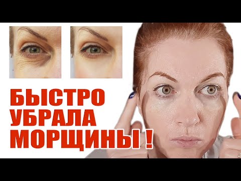 Видео: Я убрала всем морщины под глазами, самые глубокие! Рассказываю, как.