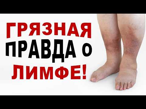 Видео: Эти советы точно помогут избавиться от отеков! Грязная правда о лимфе!