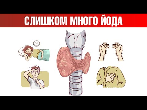 Видео: Признак №1 избытка йода в организме🧐