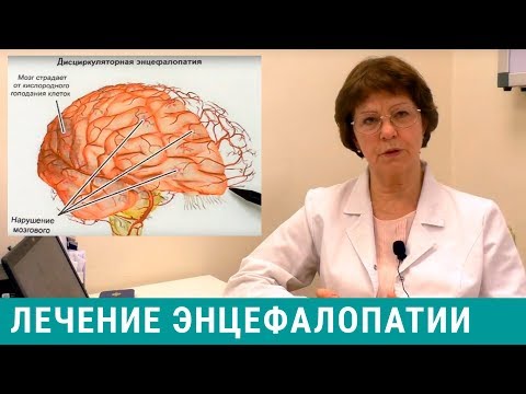 Видео: Энцефалопатия - лечение головного мозга, симптомы энцефалопатии