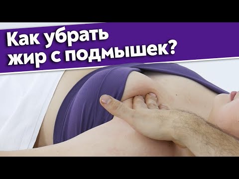 Видео: Можно ли убрать жир с передней поверхности плеча / Как убрать жир на руках?