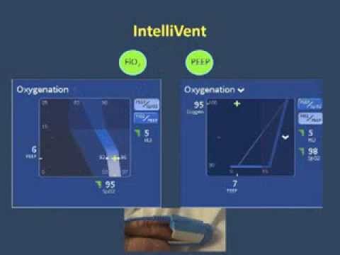 Видео: Первый опыт использования режима  InteliVent в лечении пациентов с ЧМТ(ICRS 2013) Полупан А.А.