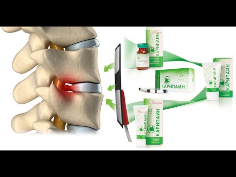 Видео: Электрофорез с карипаином в реальности. Мой личный опыт.