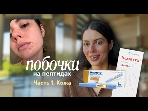 Видео: Побочки от Тирзетта Мунджаро и Оземпик часть 1 
