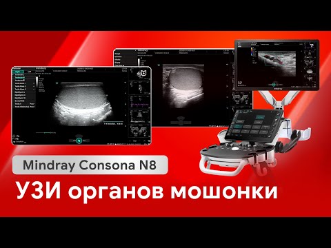 Видео: УЗИ мошонки: как работает Mindray Consona N8 в урологии?