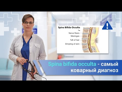 Видео: Spina bifida occulta - самая коварная патология/