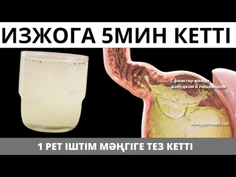 Видео: Изжогадан тез МӘҢГІГЕ Үй жағдайында айырылдым. Қыжылды қалай басуға болады