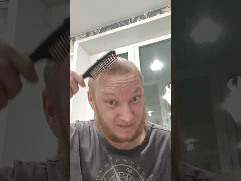 Видео: Массаж от выпадения волос, лысина. Питание, восстановление и рост волос у мужчин на голове