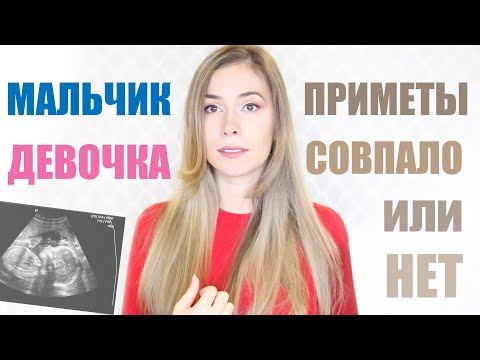 Видео: ПОЛ РЕБЕНКА! МАЛЬЧИК/ДЕВОЧКА совпал ли с признаками/приметами?