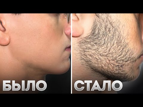 Видео: БОРОДА С НУЛЯ ЗА 3 МЕСЯЦА. РЕЗУЛЬТАТ Mr.VOLOS