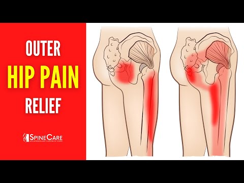 Видео: Как навсегда избавиться от боли в наружной части бедра