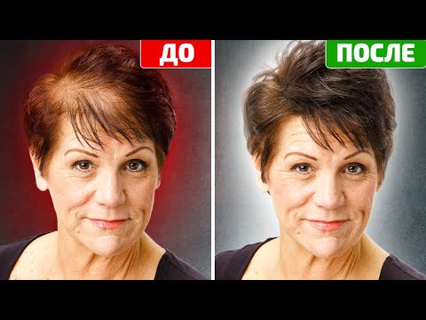 Видео: Индийский секрет раскрыт. Молниеносный рост волос и лечение облысения за 30 дней.