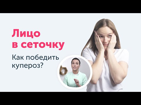 Видео: Как перестать краснеть? | Купероз и его причины