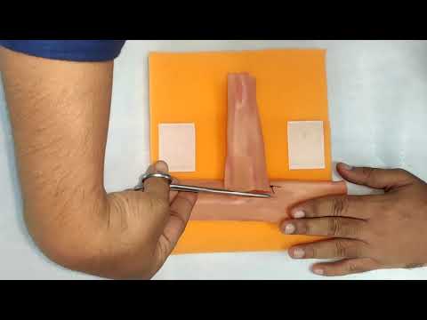 Видео: Симутомия - кишечный анастомоз "конец в бок" #кишечныйанастомоз #кишечноеушивание #Rous-En-Y #еюн...