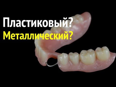 Видео: Какой крючОк Лучше? #съёмныепротезы #зубныепротезы #протезированиезубов #протезирование