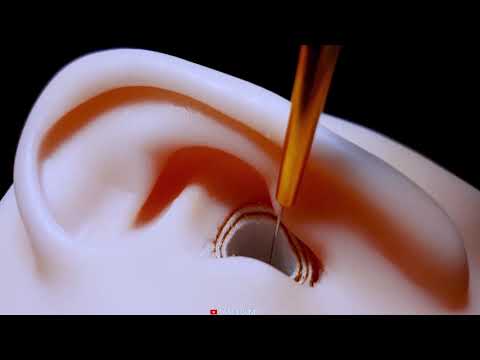 Видео: ASMR Царапание твердой внутренней стенки и копание ушей *пушистый ,железный ухочистка* ★ИНТЕНСИВНЫЙ★